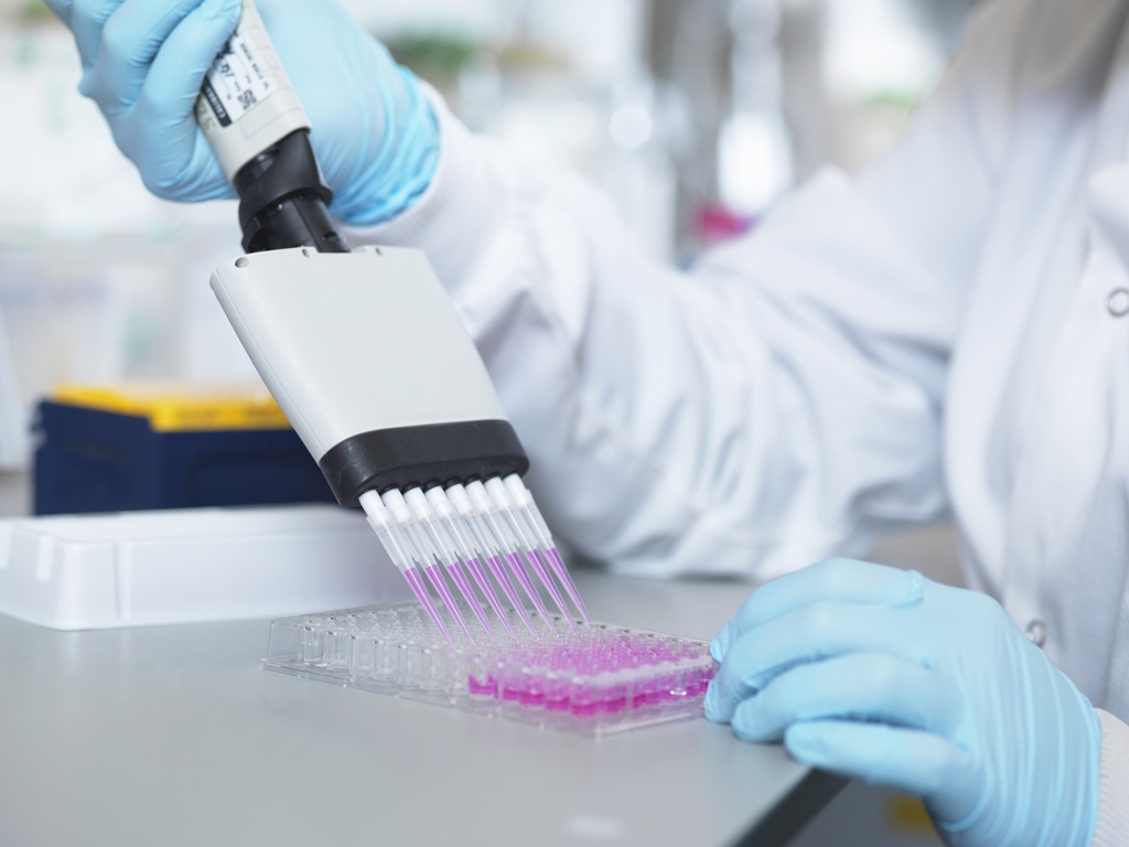Rabbit IgM ELISA Kit   